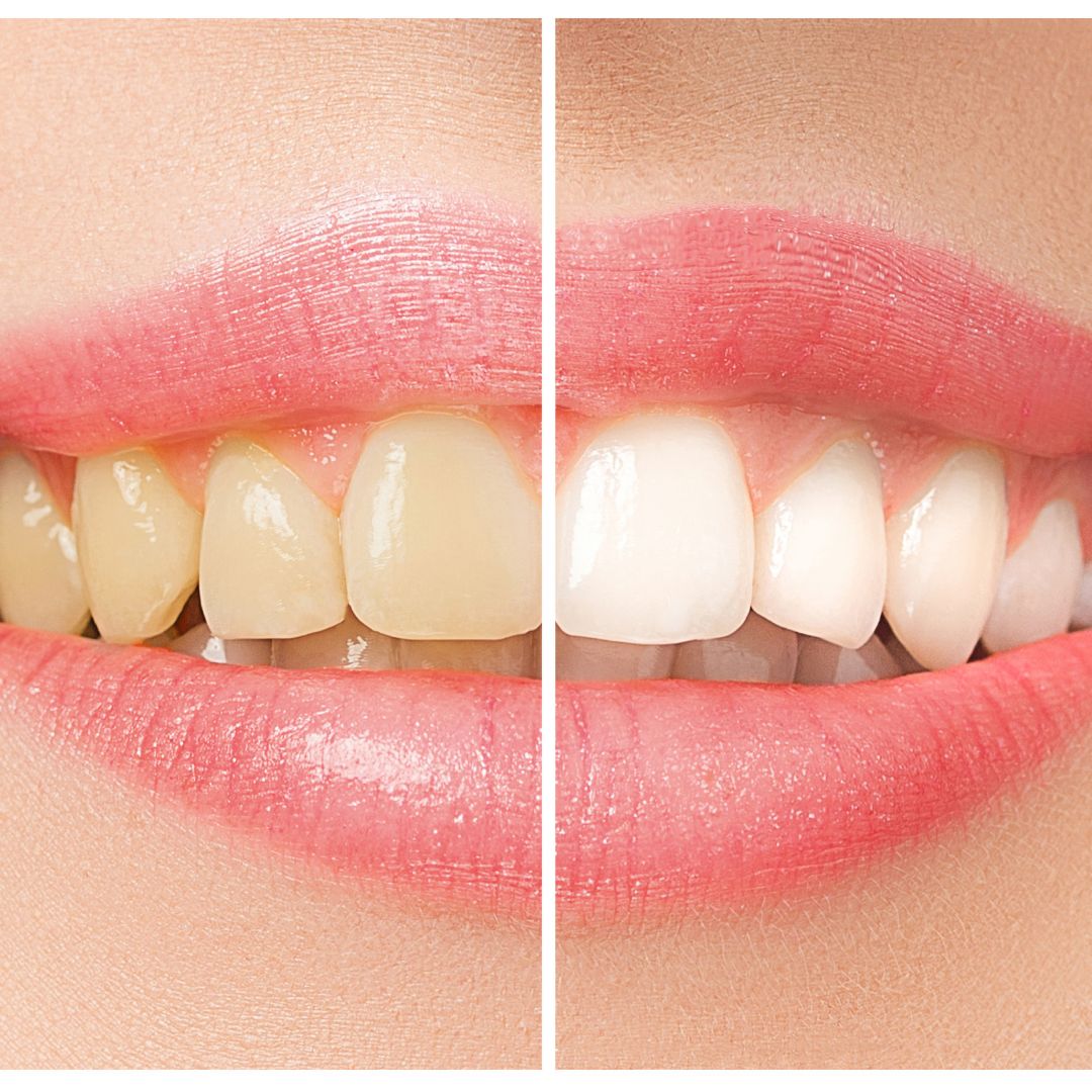 Patient Transformation 2
