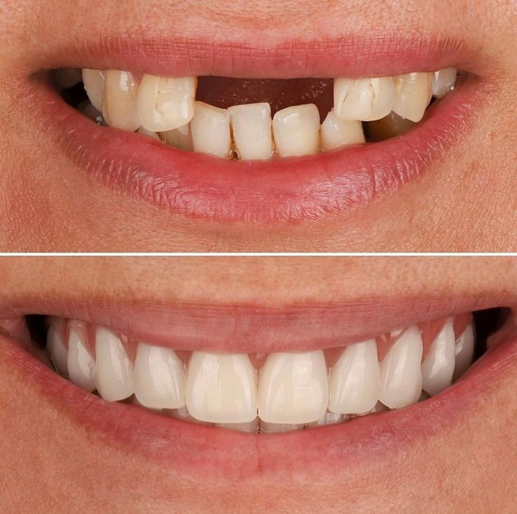 Patient Transformation 3