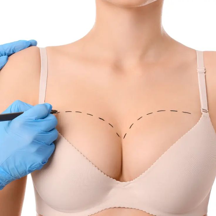 Ästhetik Transformation 1